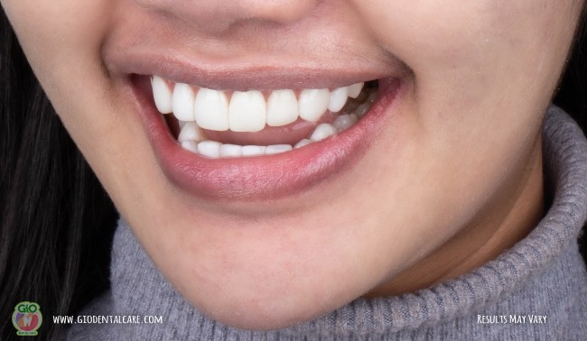 get-your-smile-here--1